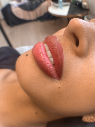 𝙱𝙴𝙵𝙾𝚁𝙴 𝙰𝙽𝙳 𝙰𝙵𝚃𝙴𝚁 

lip
