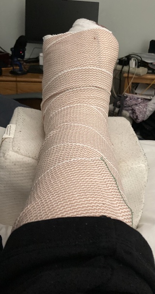 pie uncomfortable this splint