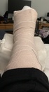 My foot is so uncomfortable in this splint. Can I please have pictures of animals to make me feel better. Thank you. https://t.co/BmW7pUA9Cm