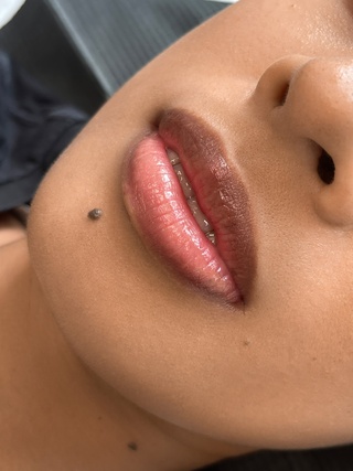 𝙱𝙴𝙵𝙾𝚁𝙴 𝙰𝙽𝙳 𝙰𝙵𝚃𝙴𝚁 

lip