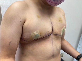 impossible to translate without proper context top surgery 10/26/22