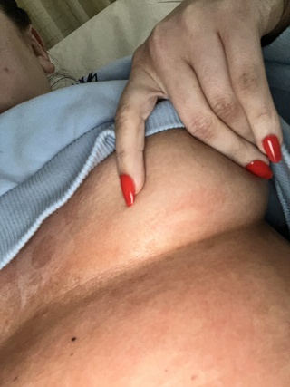 found out have abscess