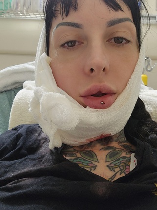 i'm still waiting surgery