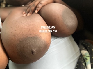 should get breast reduction