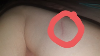healed lindo still weak