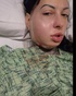 I deleted the original tweet, because people kept assuming I saw a plastic surgeon for cosmetic reasons. But in reality, I saw one at the hospital, because my jaw was falling off my face from the impact of the airbag. The surgeon had to fix my entire jaw, and wire it shut so it… https://t.co/cBgrfFRKCR https://t.co/z9OrCkxbNW